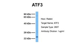 ATF3 Antibody, Novus Biologicals 100 &mu;L; Unconjugated:Antibodies, Polyclonal